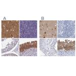 SRGAP3 Antibody in Immunohistochemistry (IHC)