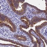 SRGAP3 Antibody in Immunohistochemistry (IHC)