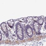 SRGAP3 Antibody in Immunohistochemistry (IHC)