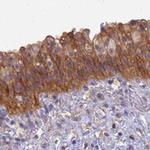 SRGAP3 Antibody in Immunohistochemistry (IHC)