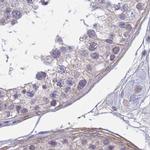 SRGAP3 Antibody in Immunohistochemistry (IHC)