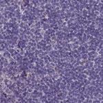 SRGAP3 Antibody in Immunohistochemistry (IHC)