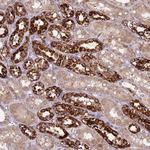 FECH Antibody in Immunohistochemistry (Paraffin) (IHC (P))