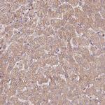 FECH Antibody in Immunohistochemistry (Paraffin) (IHC (P))