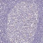 FECH Antibody in Immunohistochemistry (Paraffin) (IHC (P))