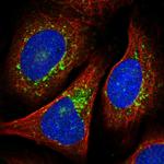 VTI1B Antibody in Immunocytochemistry (ICC/IF)