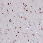 VTI1B Antibody in Immunohistochemistry (Paraffin) (IHC (P))