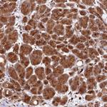 ZNF565 Antibody in Immunohistochemistry (Paraffin) (IHC (P))