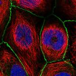 WDPCP Antibody in Immunocytochemistry (ICC/IF)