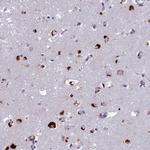 WDPCP Antibody in Immunohistochemistry (Paraffin) (IHC (P))