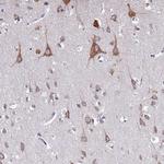 WDR35 Antibody in Immunohistochemistry (Paraffin) (IHC (P))