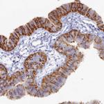 WDR35 Antibody in Immunohistochemistry (Paraffin) (IHC (P))