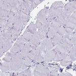 WDR35 Antibody in Immunohistochemistry (Paraffin) (IHC (P))