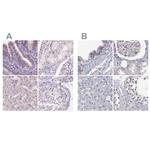 NHP2 Antibody in Immunohistochemistry (IHC)