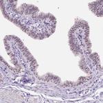 NHP2 Antibody in Immunohistochemistry (IHC)