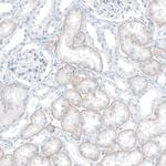 SLC22A8 Antibody in Immunohistochemistry (Paraffin) (IHC (P))