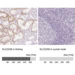 SLC22A8 Antibody