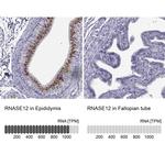 RNase12 Antibody in Immunohistochemistry (IHC)