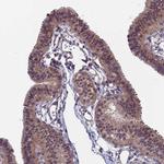 SDOS Antibody in Immunohistochemistry (IHC)