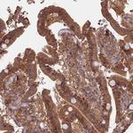 SDOS Antibody in Immunohistochemistry (IHC)