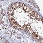 SDOS Antibody in Immunohistochemistry (IHC)