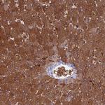 SDOS Antibody in Immunohistochemistry (IHC)