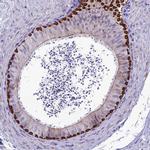 SPTLC3 Antibody in Immunohistochemistry (IHC)