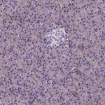 SPTLC3 Antibody in Immunohistochemistry (IHC)