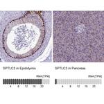 SPTLC3 Antibody