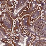 ATP6V0A2 Antibody in Immunohistochemistry (Paraffin) (IHC (P))