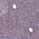 NELF Antibody in Immunohistochemistry (IHC)