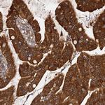 AMPK beta-2 Antibody in Immunohistochemistry (Paraffin) (IHC (P))