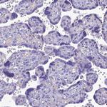 SLC13A5 Antibody in Immunohistochemistry (IHC)