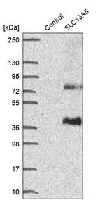 SLC13A5 Antibody in Western Blot (WB)