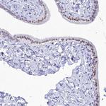 DHX40 Antibody in Immunohistochemistry (Paraffin) (IHC (P))