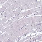 DHX40 Antibody in Immunohistochemistry (Paraffin) (IHC (P))