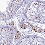 DHX40 Antibody in Immunohistochemistry (Paraffin) (IHC (P))