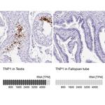 TNP1 Antibody in Immunohistochemistry (IHC)