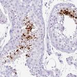 TNP1 Antibody in Immunohistochemistry (IHC)