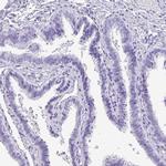 TNP1 Antibody in Immunohistochemistry (IHC)