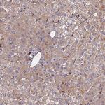 EXT1 Antibody in Immunohistochemistry (Paraffin) (IHC (P))