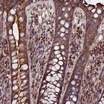 EXT1 Antibody in Immunohistochemistry (Paraffin) (IHC (P))