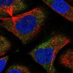 CNOT6 Antibody in Immunocytochemistry (ICC/IF)