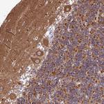 CNOT6 Antibody in Immunohistochemistry (Paraffin) (IHC (P))