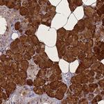 STATH Antibody in Immunohistochemistry (Paraffin) (IHC (P))