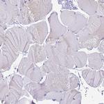 STATH Antibody in Immunohistochemistry (Paraffin) (IHC (P))