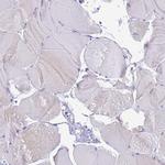 STATH Antibody in Immunohistochemistry (IHC)