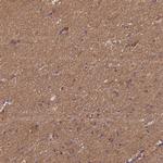 ENOPH1 Antibody in Immunohistochemistry (IHC)