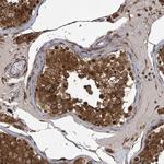 KLC1 Antibody in Immunohistochemistry (Paraffin) (IHC (P))