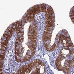 GNPNAT1 Antibody in Immunohistochemistry (Paraffin) (IHC (P))